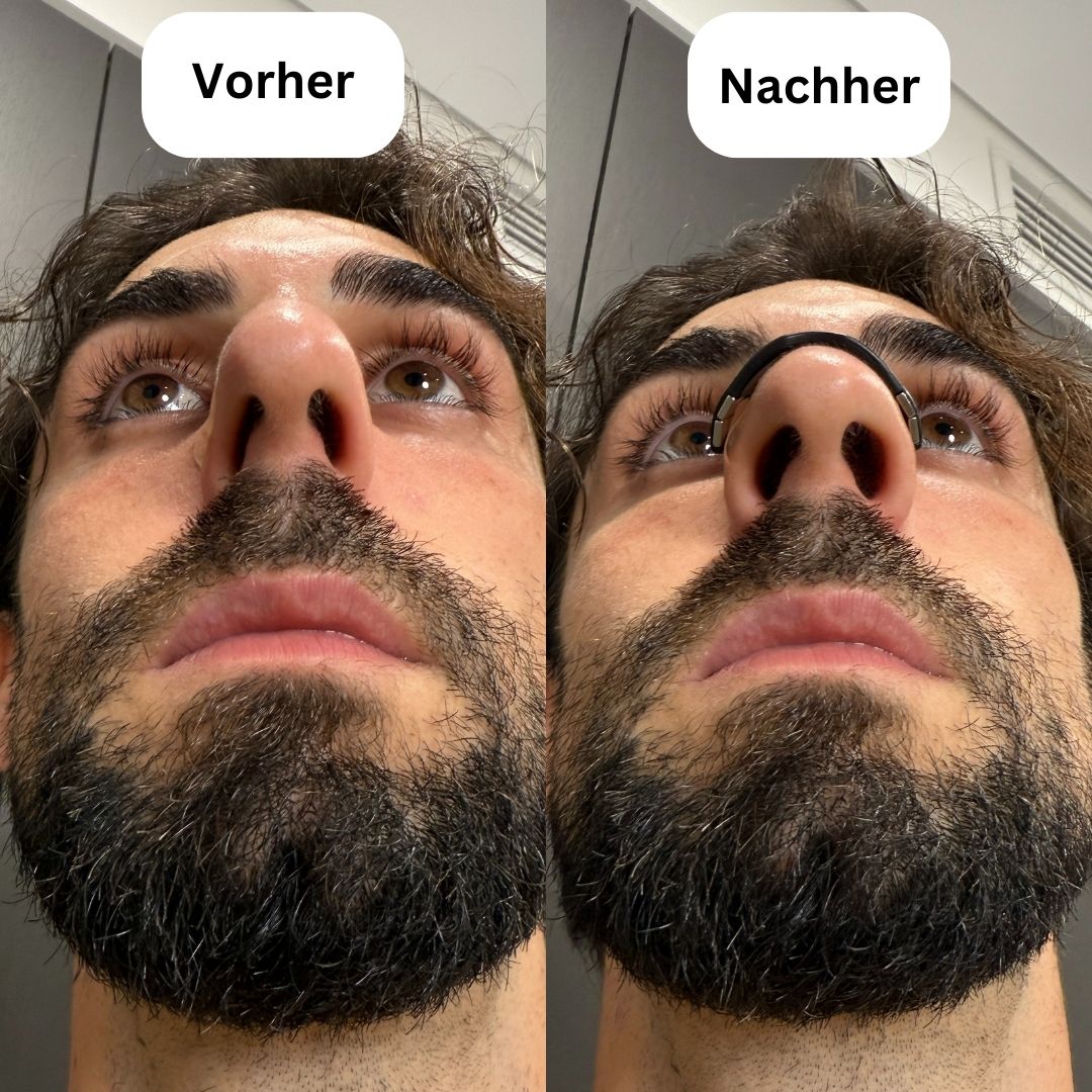 Flowstrips® Pro magnetische Nasenpflaster